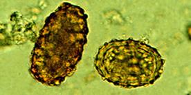 Description : A. lumbricoides fertilized and unfertilized eggs